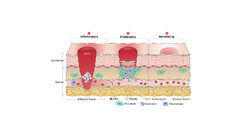 Advances and impact of human amniotic membrane and human amniotic-based materials in wound healing application پیشرفت ها و تاثیر غشای آمنیوتیک انسان و انسان مواد مبتنی بر آمنیوتیک در کاربرد ترمیم زخم شرکت دانش بنیان پیشگامان ترمیم و شفای پارس-پارس ترمیم