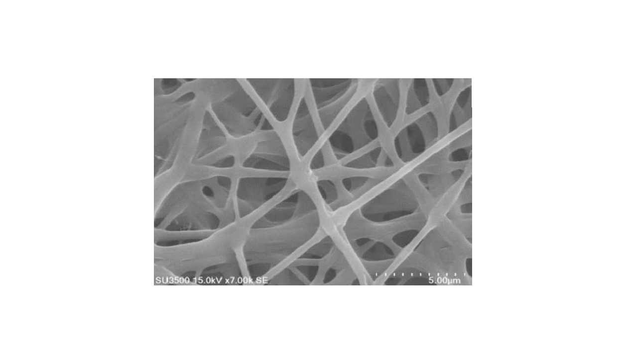 زخمپوشنوین نانوالیافی پلیمری حاوی داروهای ضد التهاب و آنتی باکتریال جهت درمان زخمهاي پوستی شرکت دانش بنیان پیشگامان ترمیم و شفای پارس-پارس ترمیم https://parstarmim.com/new-polymer-nano-fiber-wound-dressing-containing-anti-inflammatory-and-antibacterial-drugs-for-treating-skin-wounds/12-min-2/