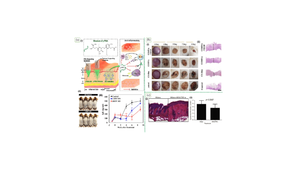 Current knowledge of immunomodulation strategies for chronic skin wound repair دانش فعلی از استراتژی‌های تعدیل ایمنی برای ترمیم زخم مزمن پوست خدمات شرکت دانش بنیان پیشگامان ترمیم و شفای پارس-پارس ترمیم