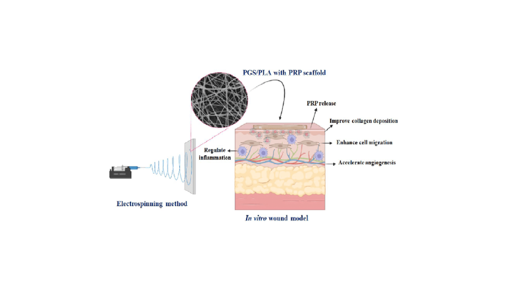 Enhanced wound regeneration by PGS/PLA fiber dressing containing platelet‑rich plasma: an in vitro study بهبود بازسازی زخم توسط پانسمان فیبر PGS/PLA حاوی پلاسمای غنی از پلاکت: یک مطالعه آزمایشگاهی شرکت دانش بنیان پیشگامان ترمیم و شفای پارس-پارس ترمیم